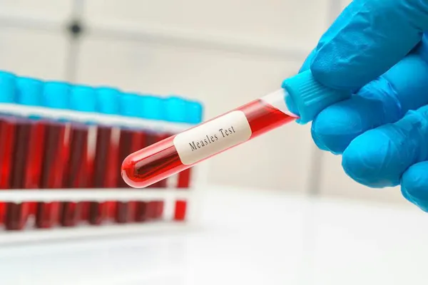 CDC vs. Pennsylvania: Why conflicting public health messages jeopardize public safety